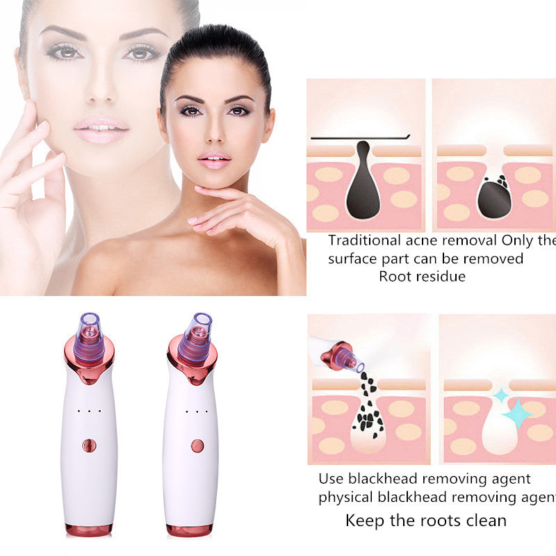 Vacuum Suction Blackhead Remover